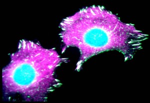 formazione delle cellule tumorali
