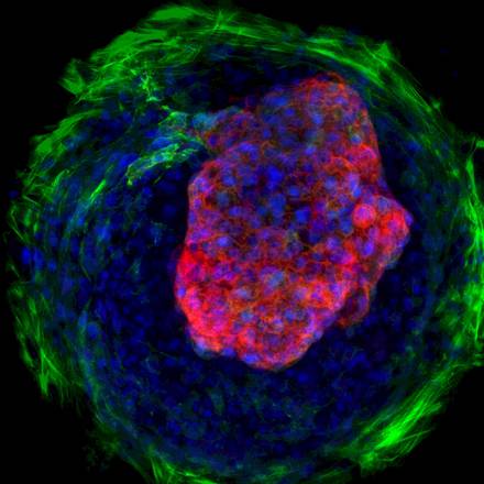 Un cuore creato dalle cellule staminali