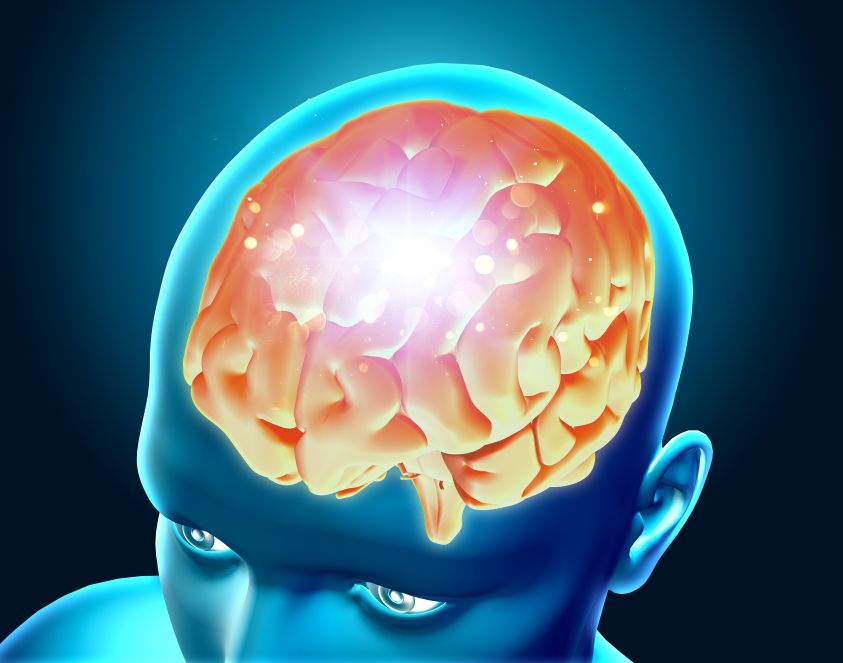 Ecco la differenza tra ictus e ischemia.