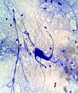 Stress e memoria: si genera un'ansia inutile che interferisce sui ricordi