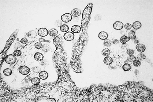 Hantavirus, vantaggi e svantaggi della lunga incubazione